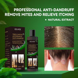 EELHOE Anti-Dandruff Shampoo - Itch Relief, Hair Loss Prevention, Oil Control & Refreshing Care